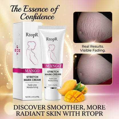 Stretch Mark Care & Moisturizing Cream for Pregnancy & Postpartum Skin