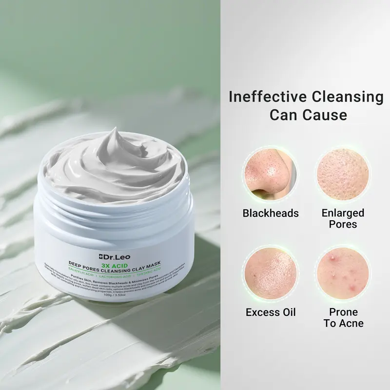 3X Acid Deep Pore Cleansing Clay Mask – Oil Control & Blackhead Care Facial Mask