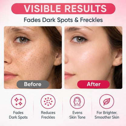 Facial Spot Brightening & Smoothing Cream for Freckles Skin