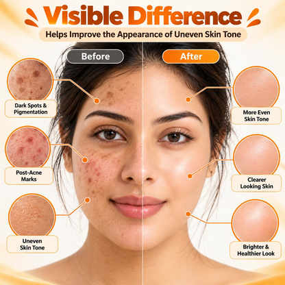 Kojic Acid Soap – Brightening & Even-Tone Skin Care