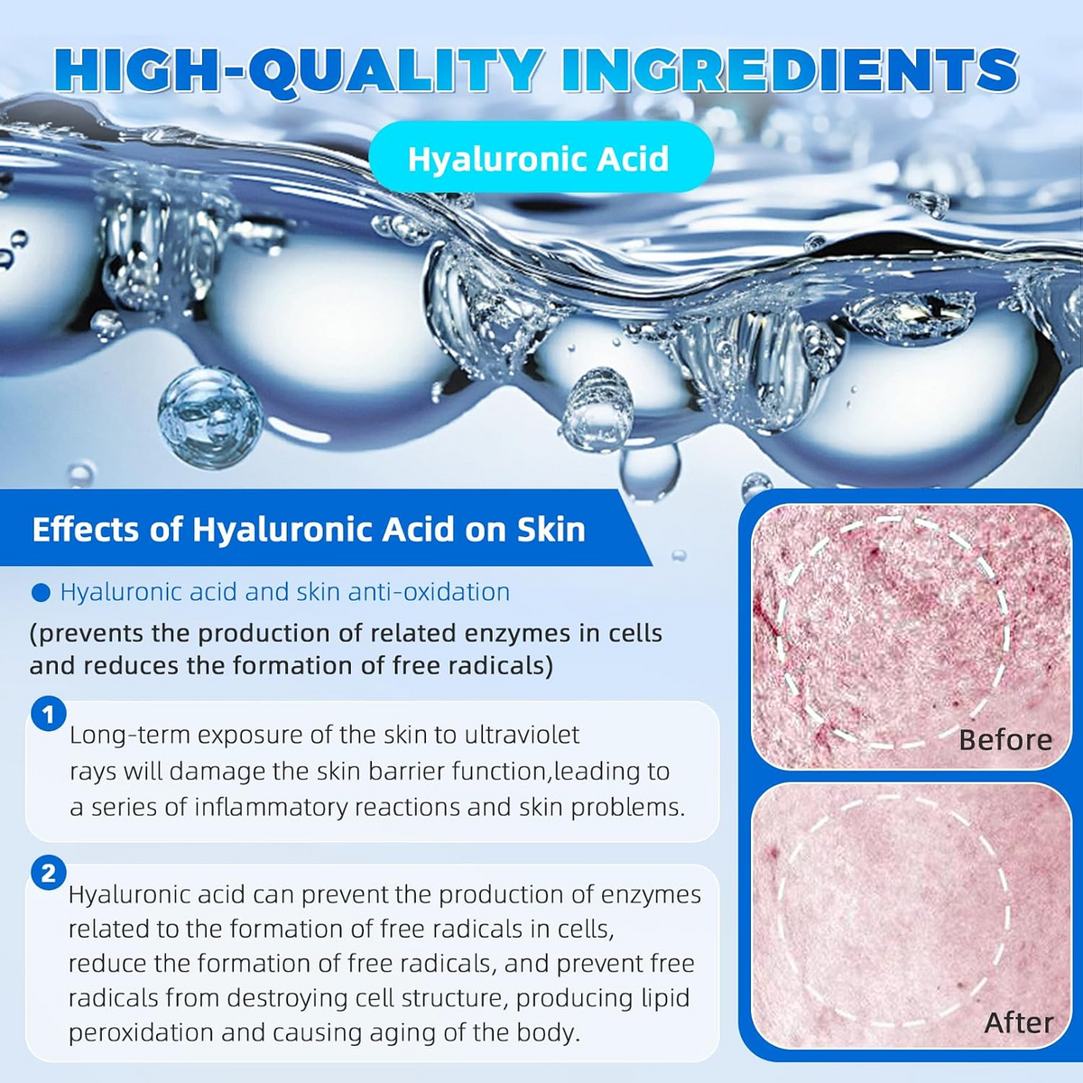 3% Hyaluronic Acid Serum Vials – Hydrating Facial Care