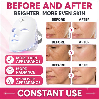 Wireless 7-Color LED Light Therapy Facial Device – Handheld Skin Care & Beauty Tool