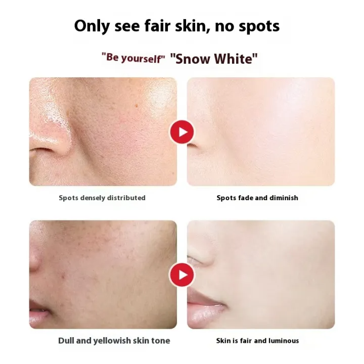 Facial Spot Brightening & Smoothing Cream for Freckles Skin