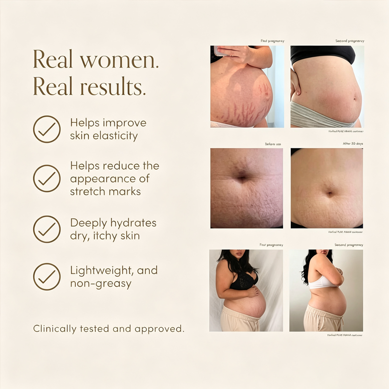 Pregnancy & Postpartum Belly Oil – Nourishing Stretch Mark Care