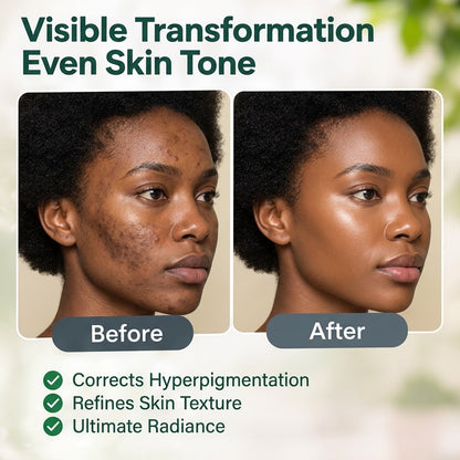 Niacinamide & Salicylic Acid Face Cream – Blemish & Oil Care