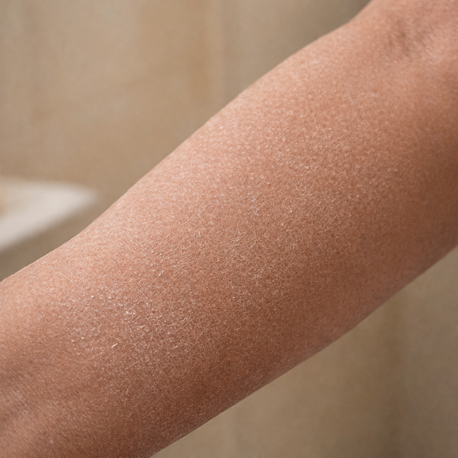 Dry, rough skin before use