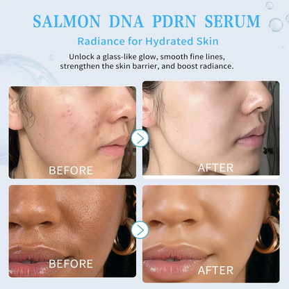3% Hyaluronic Acid Serum Vials – Hydrating Facial Care