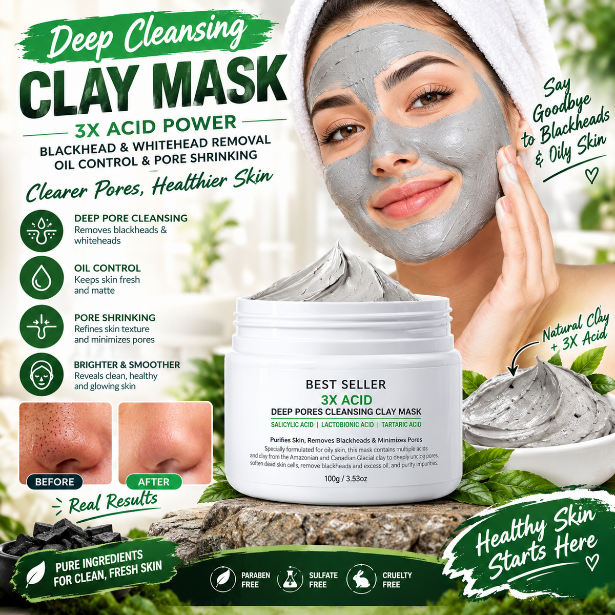 3X Acid Deep Pore Cleansing Clay Mask – Oil Control & Blackhead Care Facial Mask