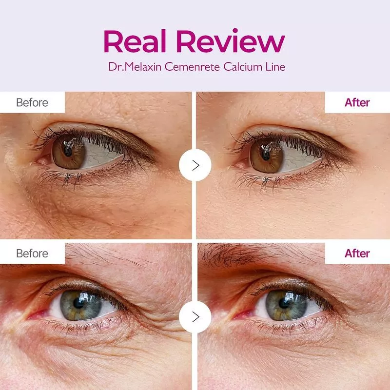 Niacinamide & Hyaluronic Acid Vegan Eye Mask Patches – Brightening, Hydrating & Anti-Wrinkle Care